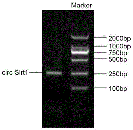 Biomarker for detecting occlusion or stenosis of coronary artery and preparation method thereof, and reagent kit containing biomarker