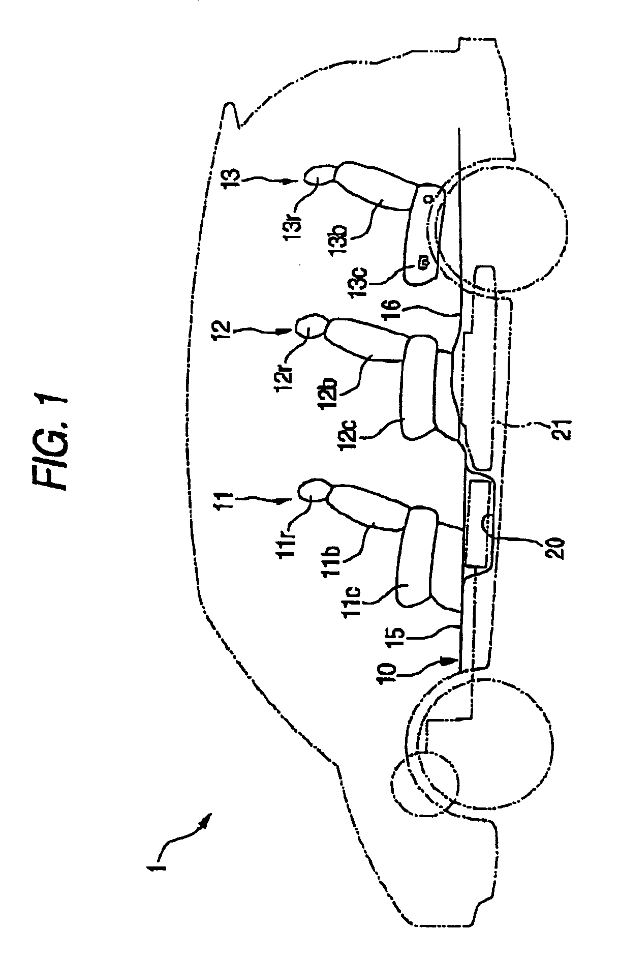 Structure for installing high-voltage equipment component to vehicle