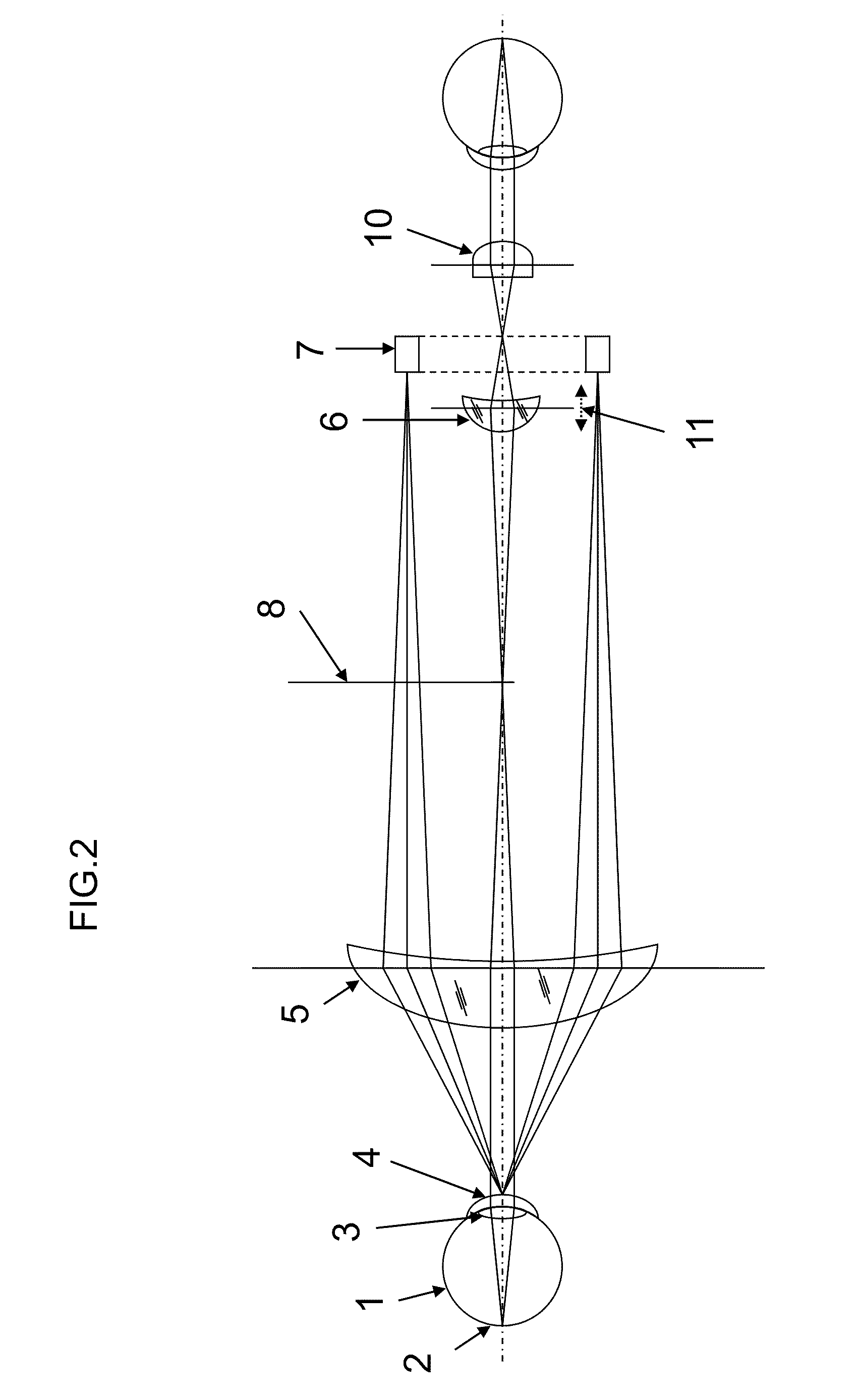 Ring light fundus camera