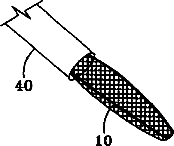 Laparoscopic stone safety device and method