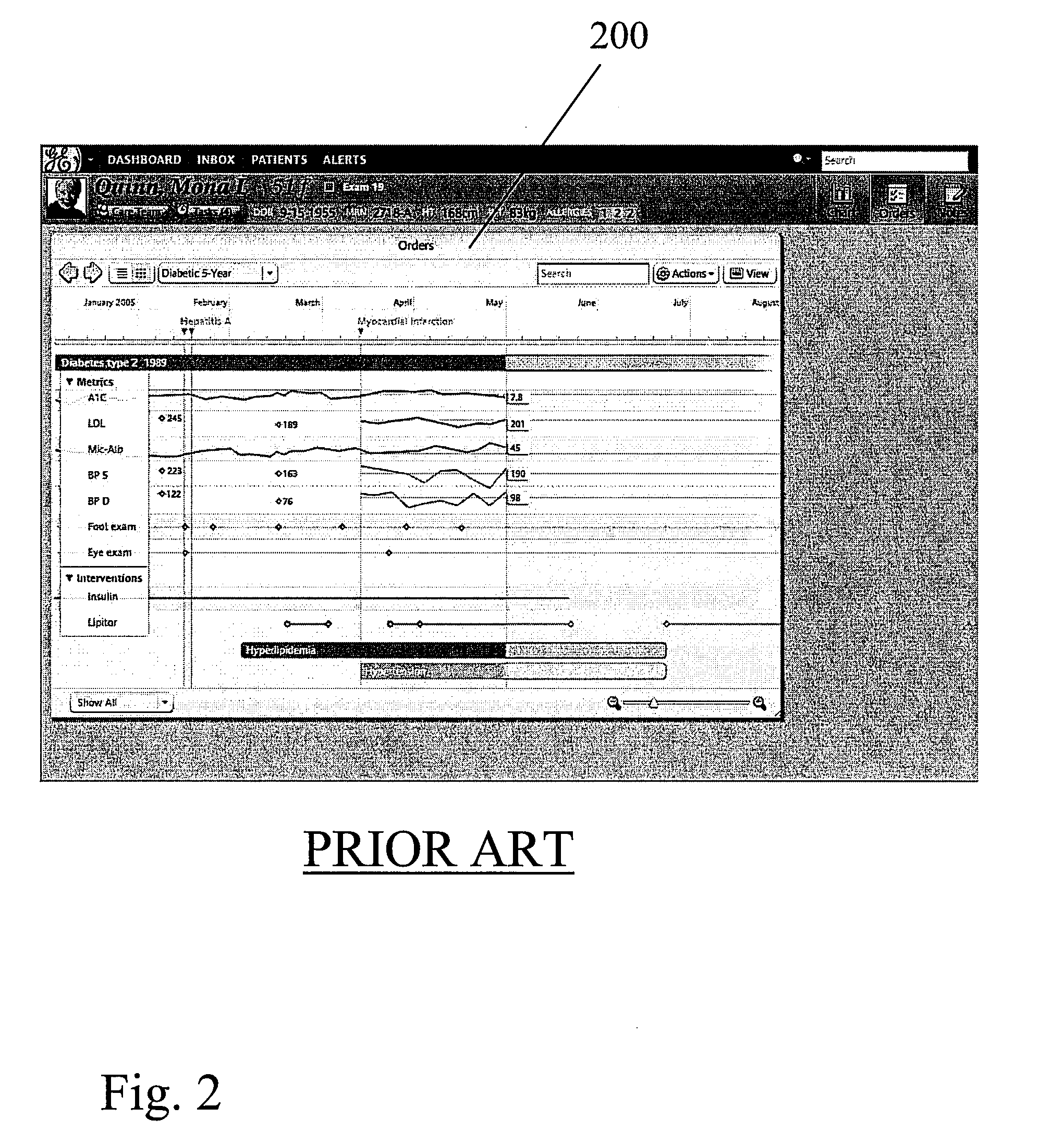 Method and System for Predictive Modeling of Patient Outcomes