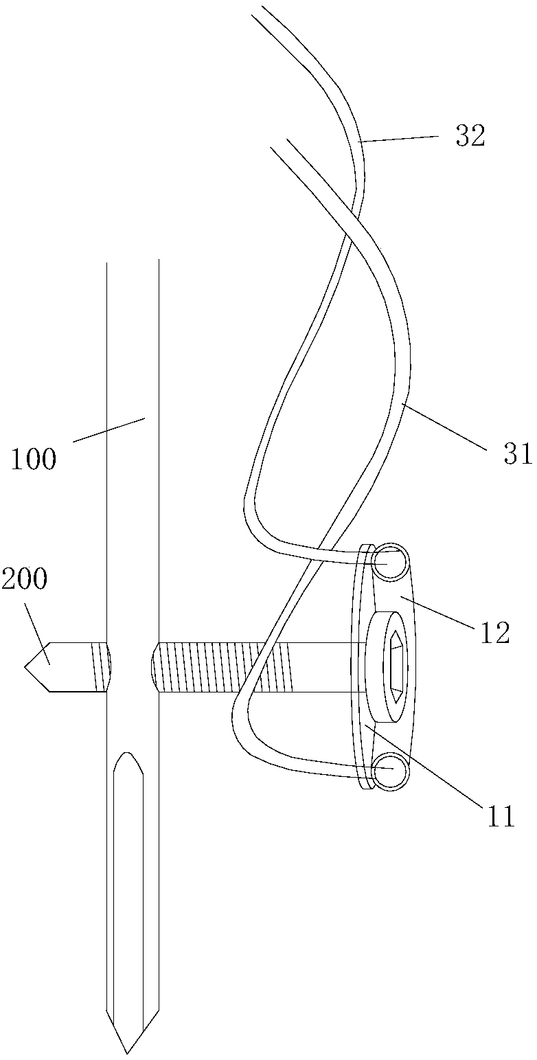 Tension band system matched with proximal femoral nail