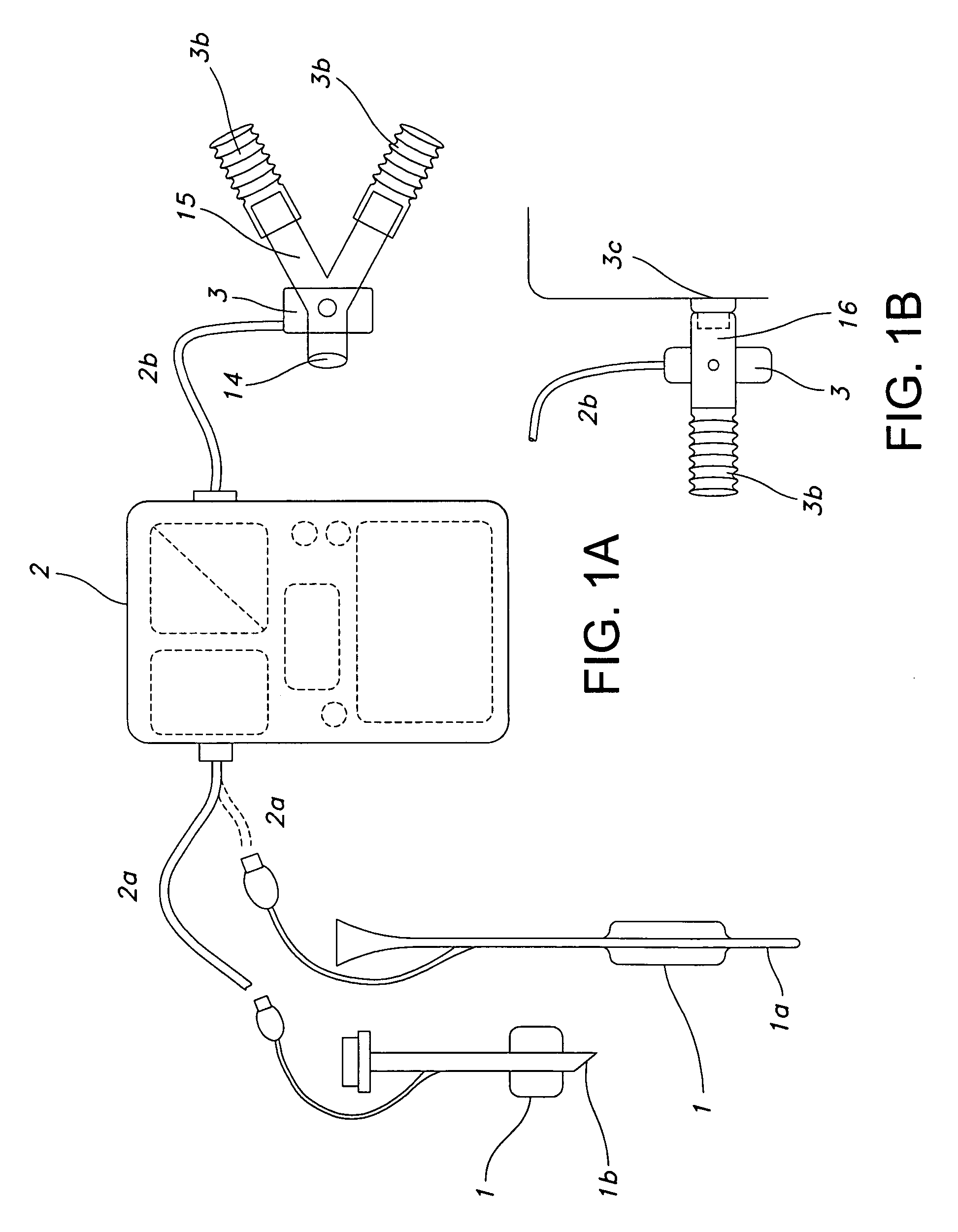 Method of triggering a ventilator