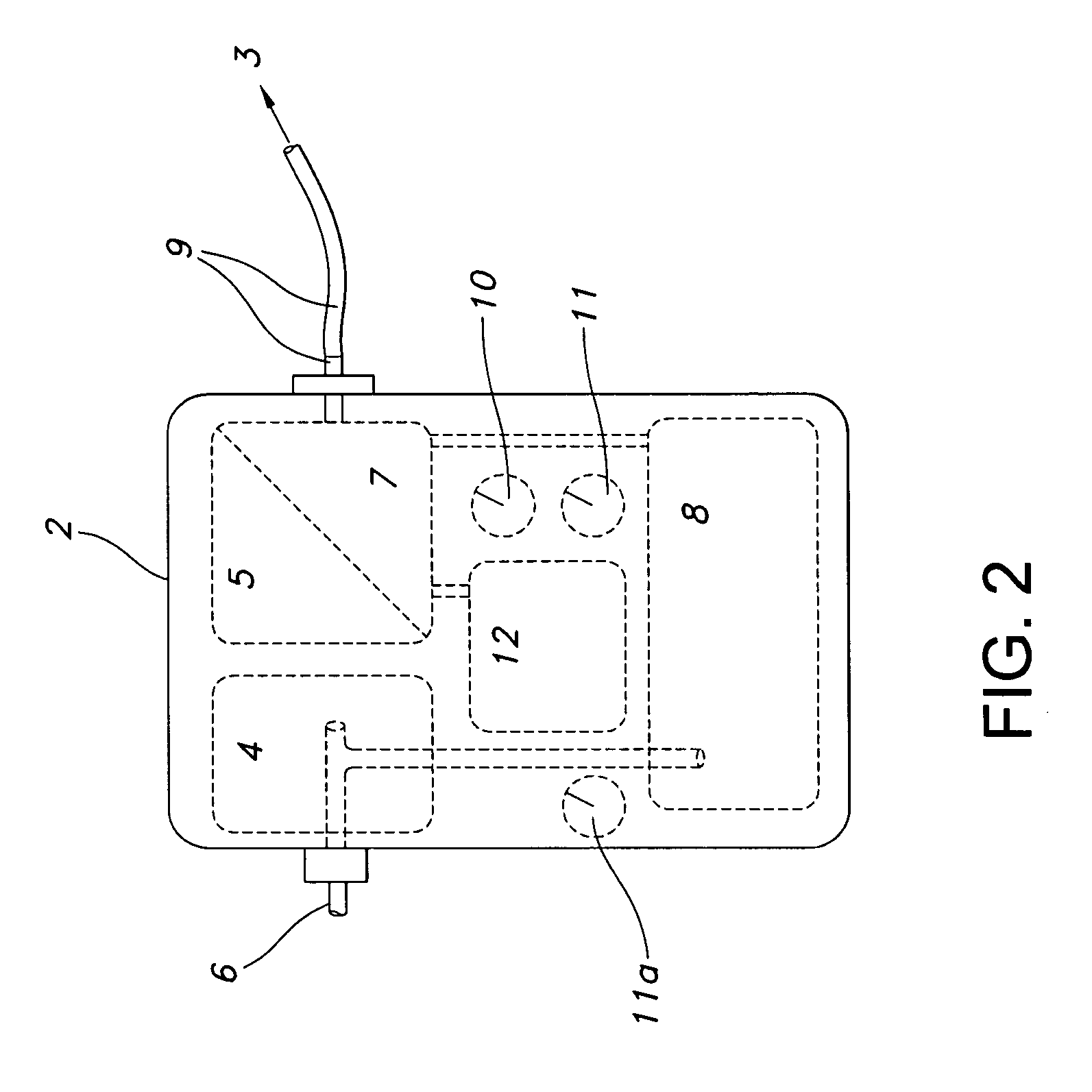 Method of triggering a ventilator