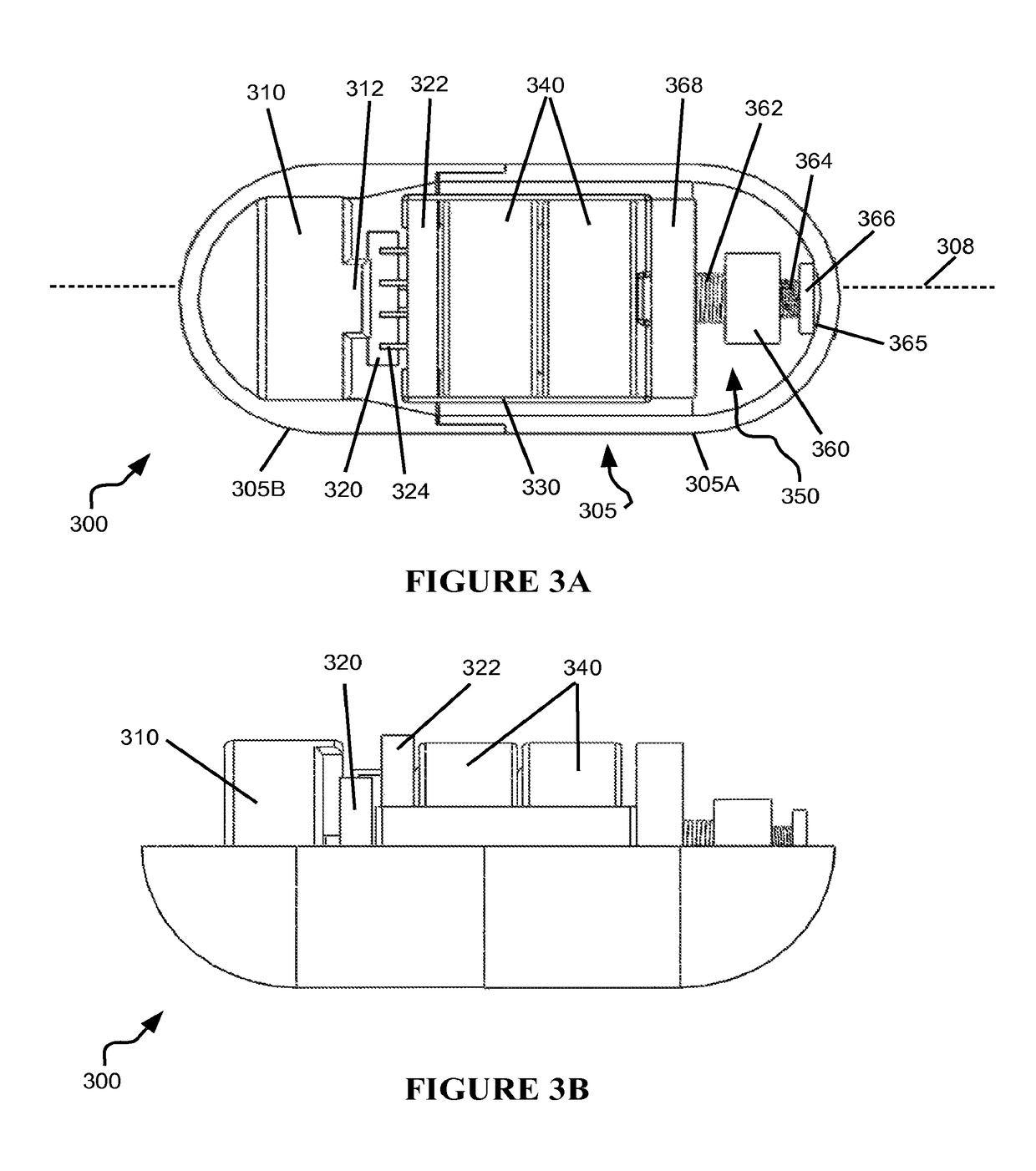 Gastrointestinal capsule and treatment method