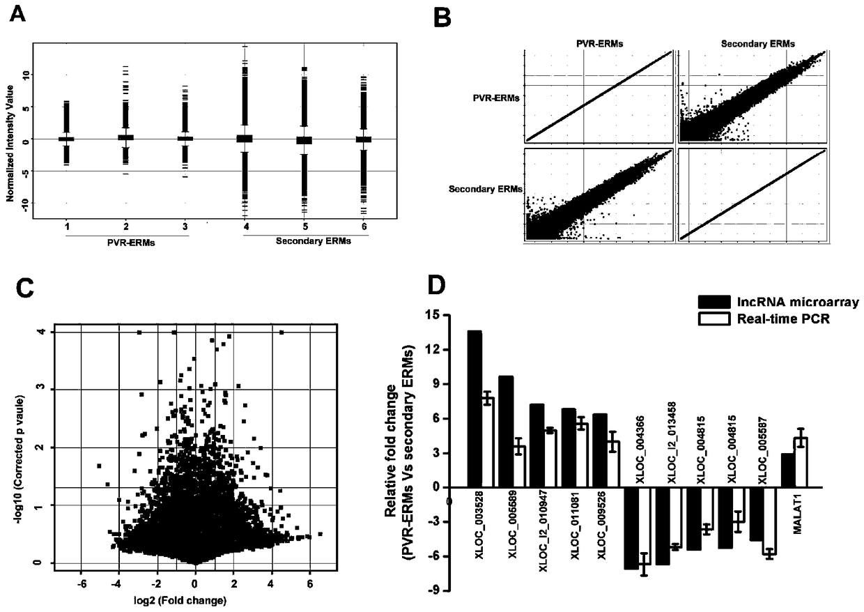 Application of lncrna-malat1 in the preparation of diagnostic reagents for proliferative vitreoretinopathy