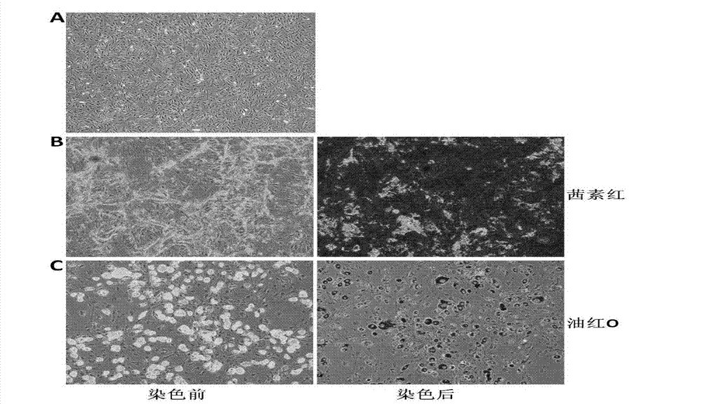 Application of microvesicles from bone marrow mesenchymal stem cells in preparing drug for treating kidney injury