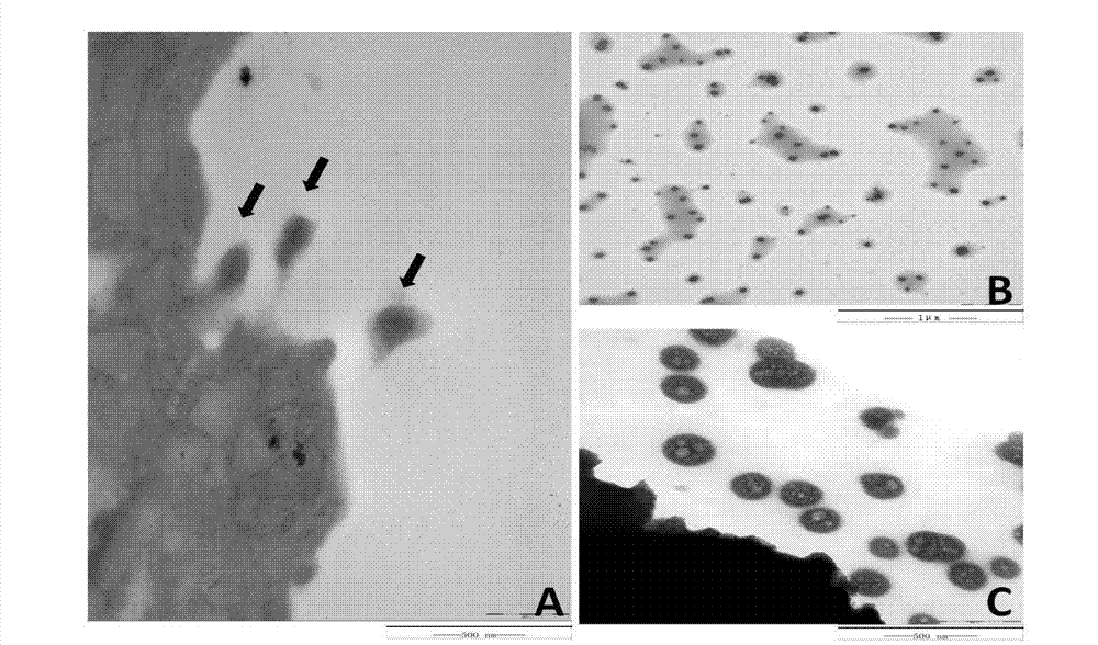 Application of microvesicles from bone marrow mesenchymal stem cells in preparing drug for treating kidney injury