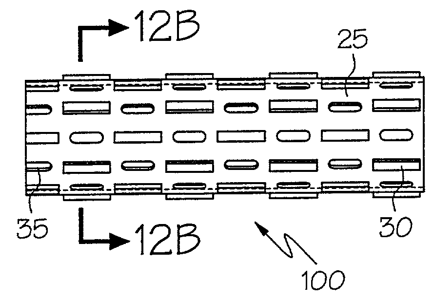 Stent with variable properties