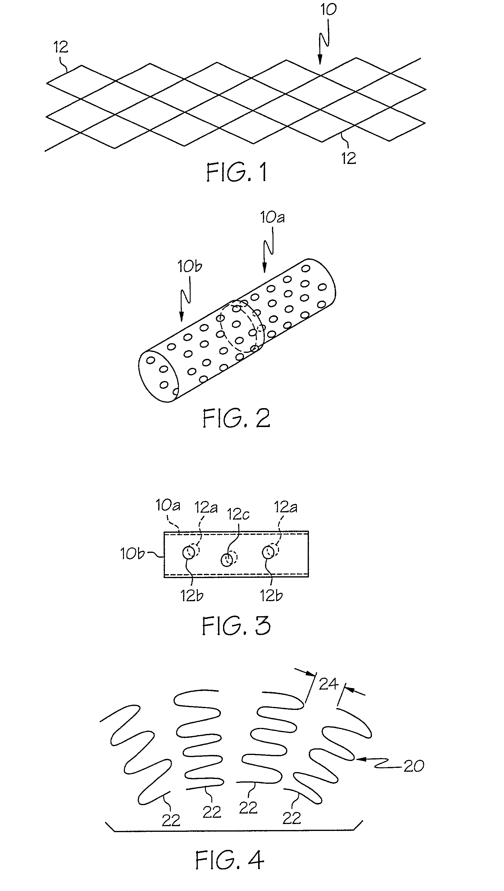 Stent with variable properties