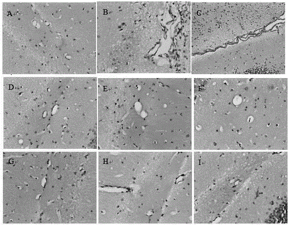 Application of astaxanthin and/or lithium chloride in preparation of drugs for preventing and treating cognitive disorder diseases caused by chronic organophosphorus poisoning