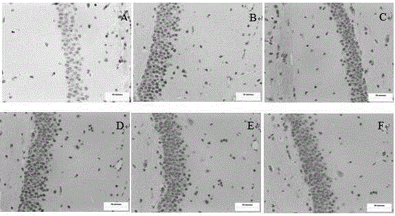 Application of astaxanthin and/or lithium chloride in preparation of drugs for preventing and treating cognitive disorder diseases caused by chronic organophosphorus poisoning