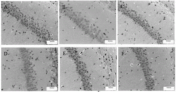 Application of astaxanthin and/or lithium chloride in preparation of drugs for preventing and treating cognitive disorder diseases caused by chronic organophosphorus poisoning