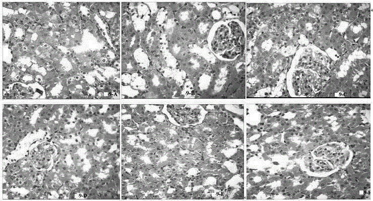 Application of Sinkiang salvia officinalis extract in preparation of medicines for preventing and treating diabetic nephropathy