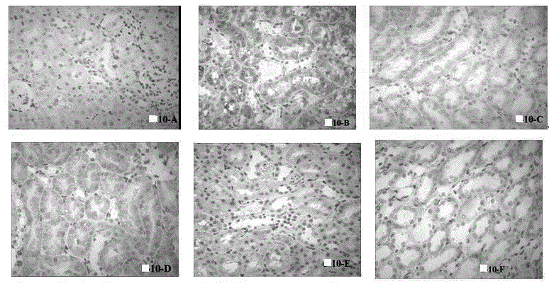 Application of Sinkiang salvia officinalis extract in preparation of medicines for preventing and treating diabetic nephropathy