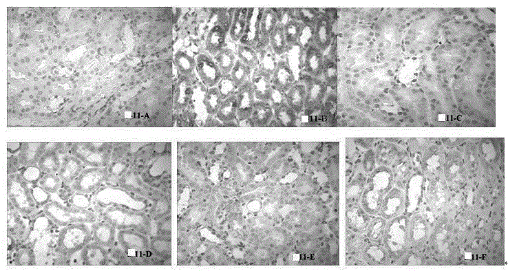 Application of Sinkiang salvia officinalis extract in preparation of medicines for preventing and treating diabetic nephropathy