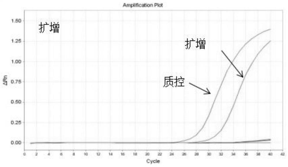 Primer group, kit and method for detecting head and neck tumor gene survival correlation