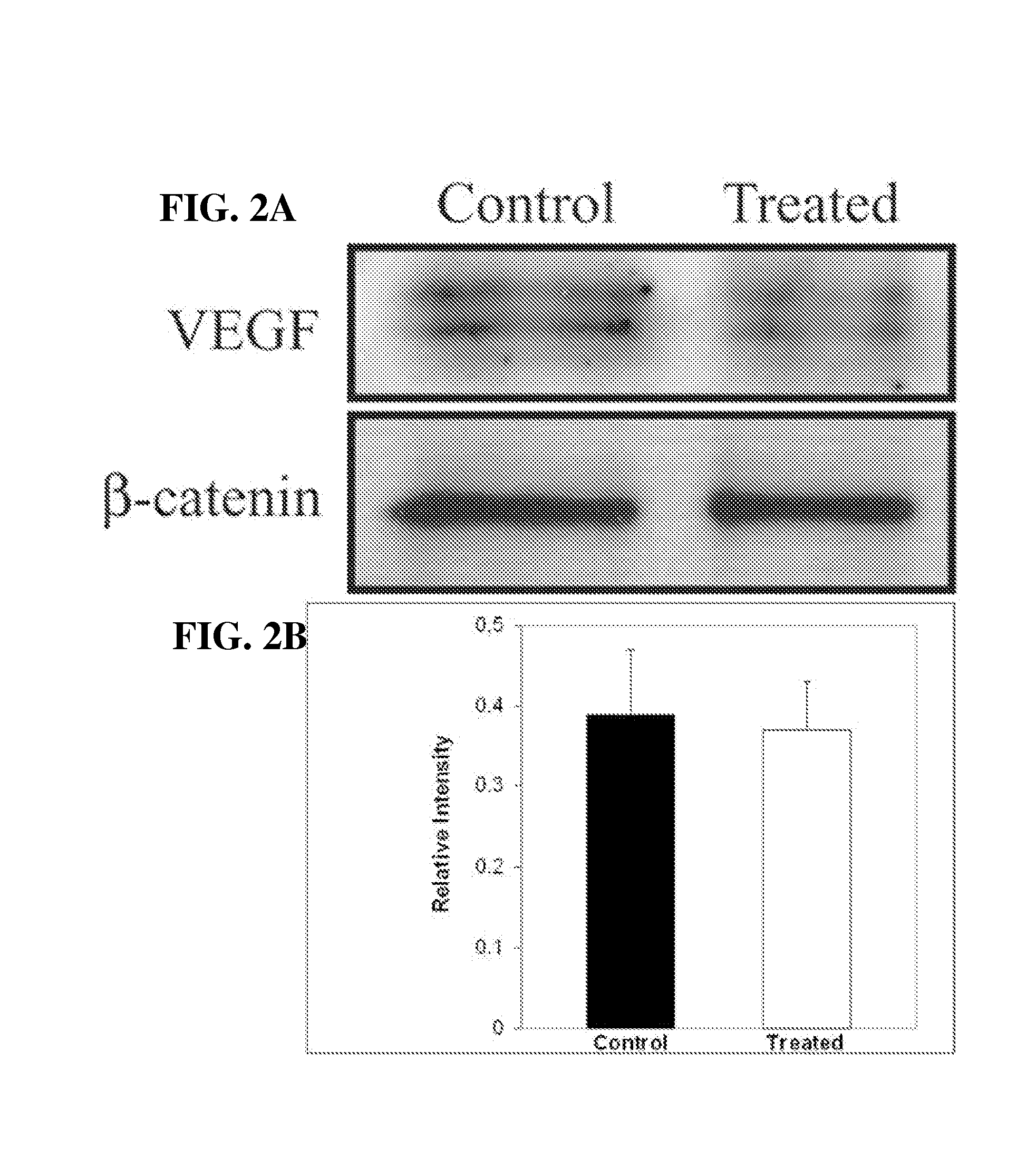 Methods and compositions for treating diseases associated with neovascualrization