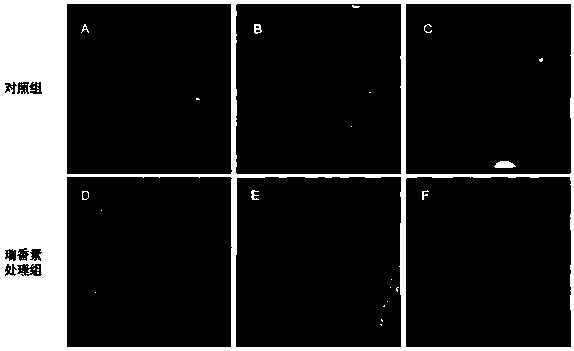 Applications of daphnetin in inhibition of Helicobacter pylori