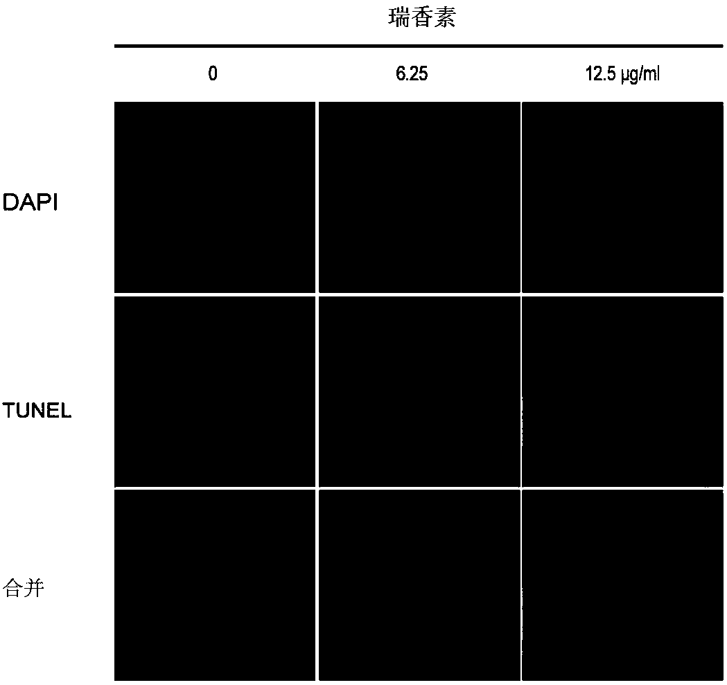 Applications of daphnetin in inhibition of Helicobacter pylori