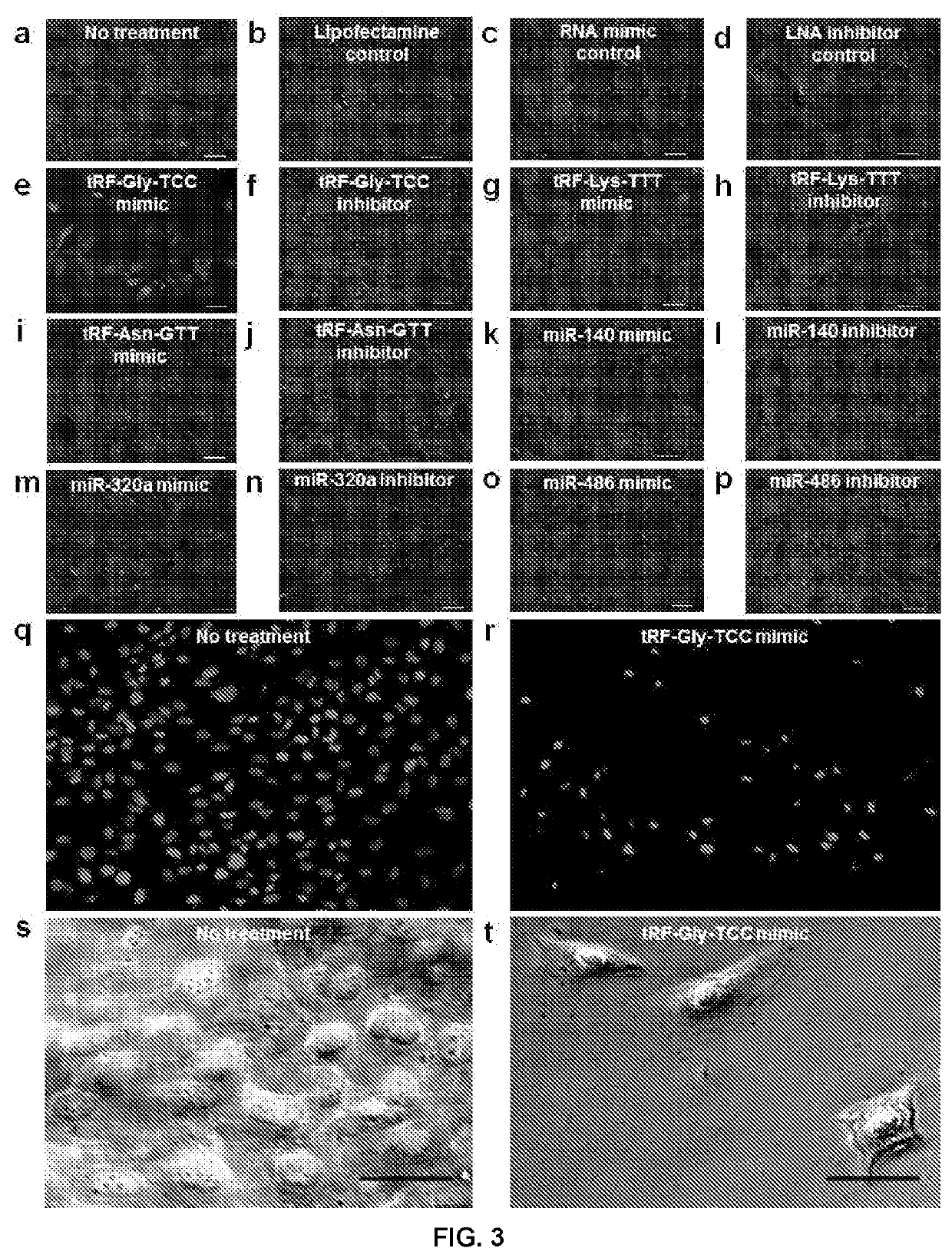 Methods of treatment and diagnosis of tumours