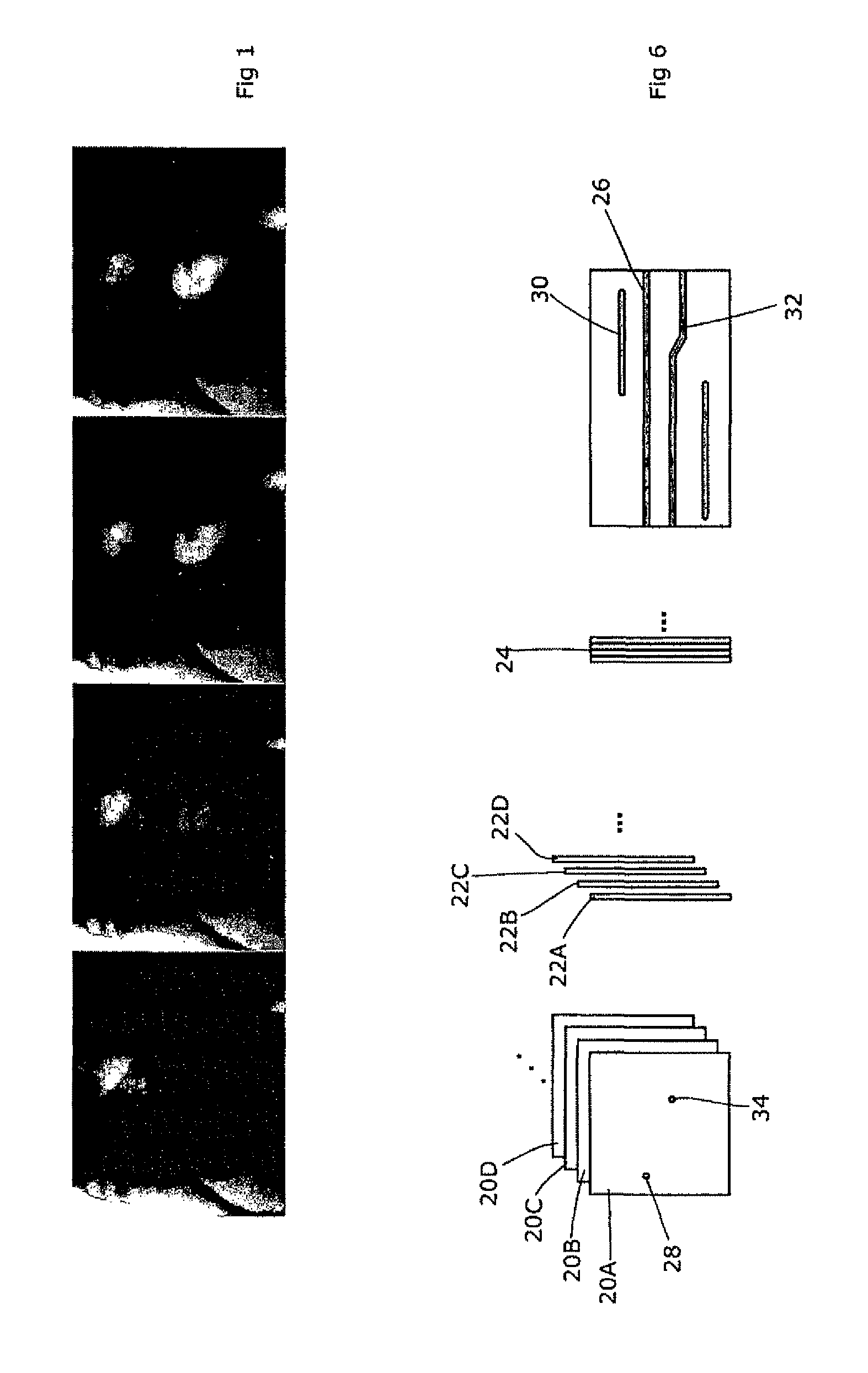 Motion artefact reduction in CT scanning