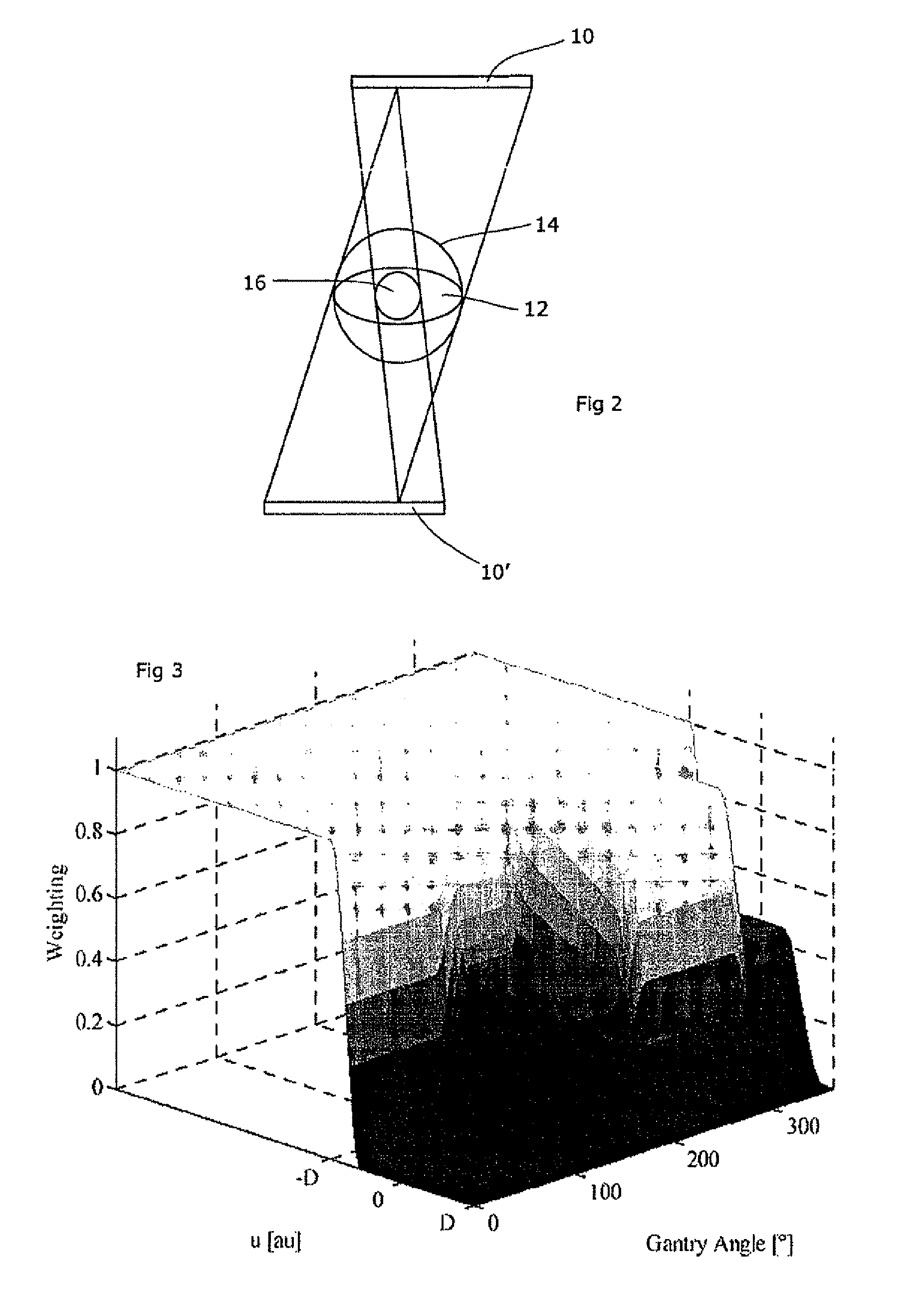 Motion artefact reduction in CT scanning