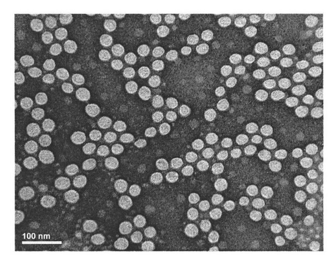 Medicament carrying nano particles and preparation method and application thereof