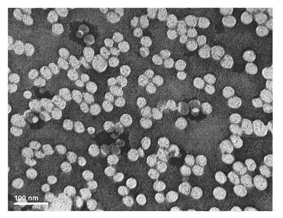 Medicament carrying nano particles and preparation method and application thereof