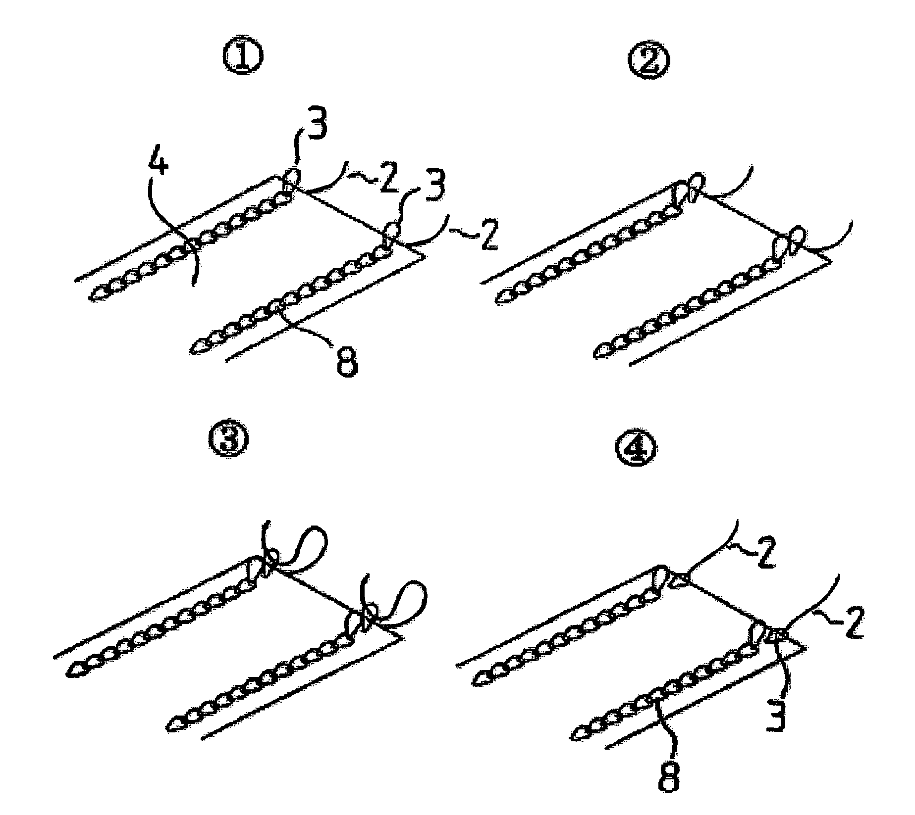 Suture reinforcement material for automatic suturing device