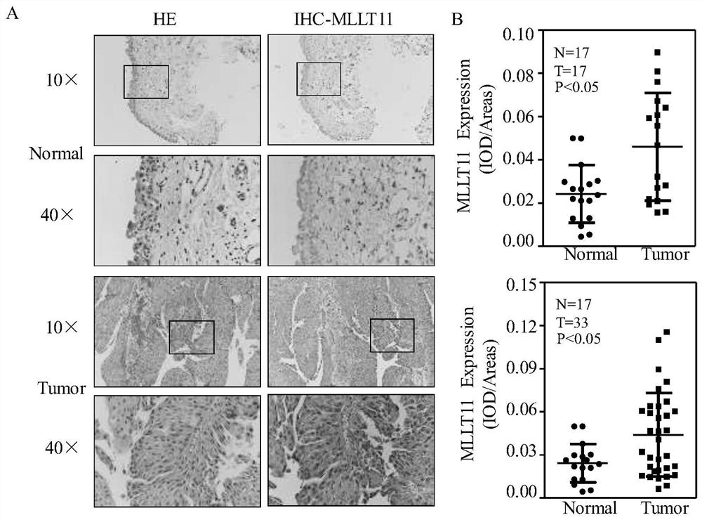 Molecular marker MLLT11 for diagnosing and treating bladder cancer and application of molecular marker MLLT11