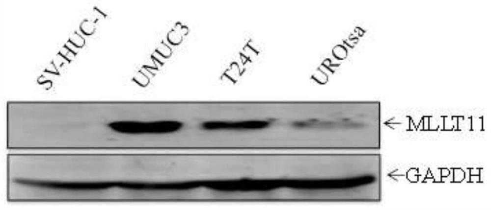 Molecular marker MLLT11 for diagnosing and treating bladder cancer and application of molecular marker MLLT11