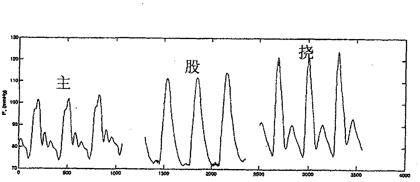 Real-time detection of vascular conditions of a subject using arterial pressure waveform analysis