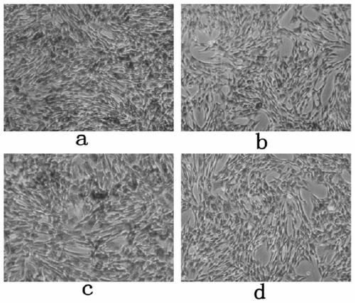 Application of clozapine in delaying senescence of cultured mesenchymal stem cells