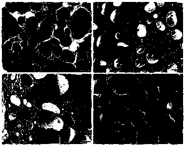 Pharmaceutical composition for treating hashimoto thyroiditis and preparation method thereof