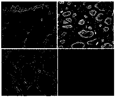 Pharmaceutical composition for treating hashimoto thyroiditis and preparation method thereof