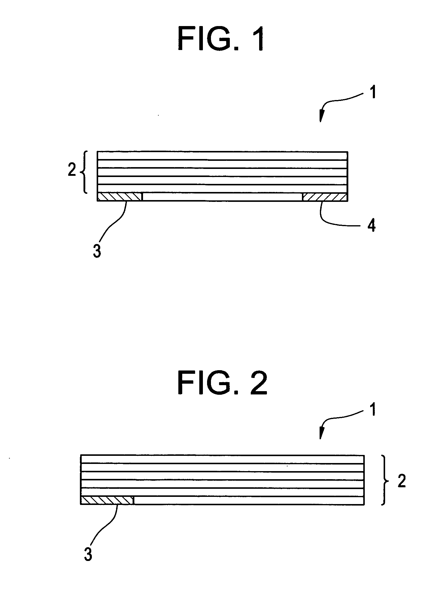 Soft tissue implants with improved interfaces