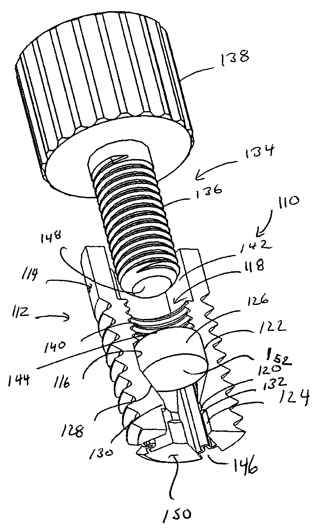 Expandable dental implants of high surface area and methods of expanding the same