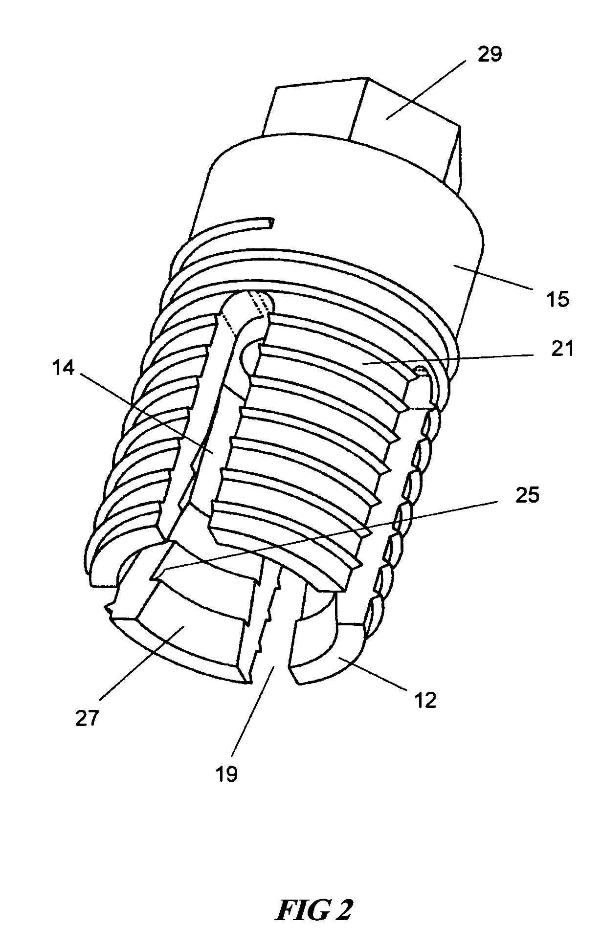 Expandable dental implants of high surface area and methods of expanding the same