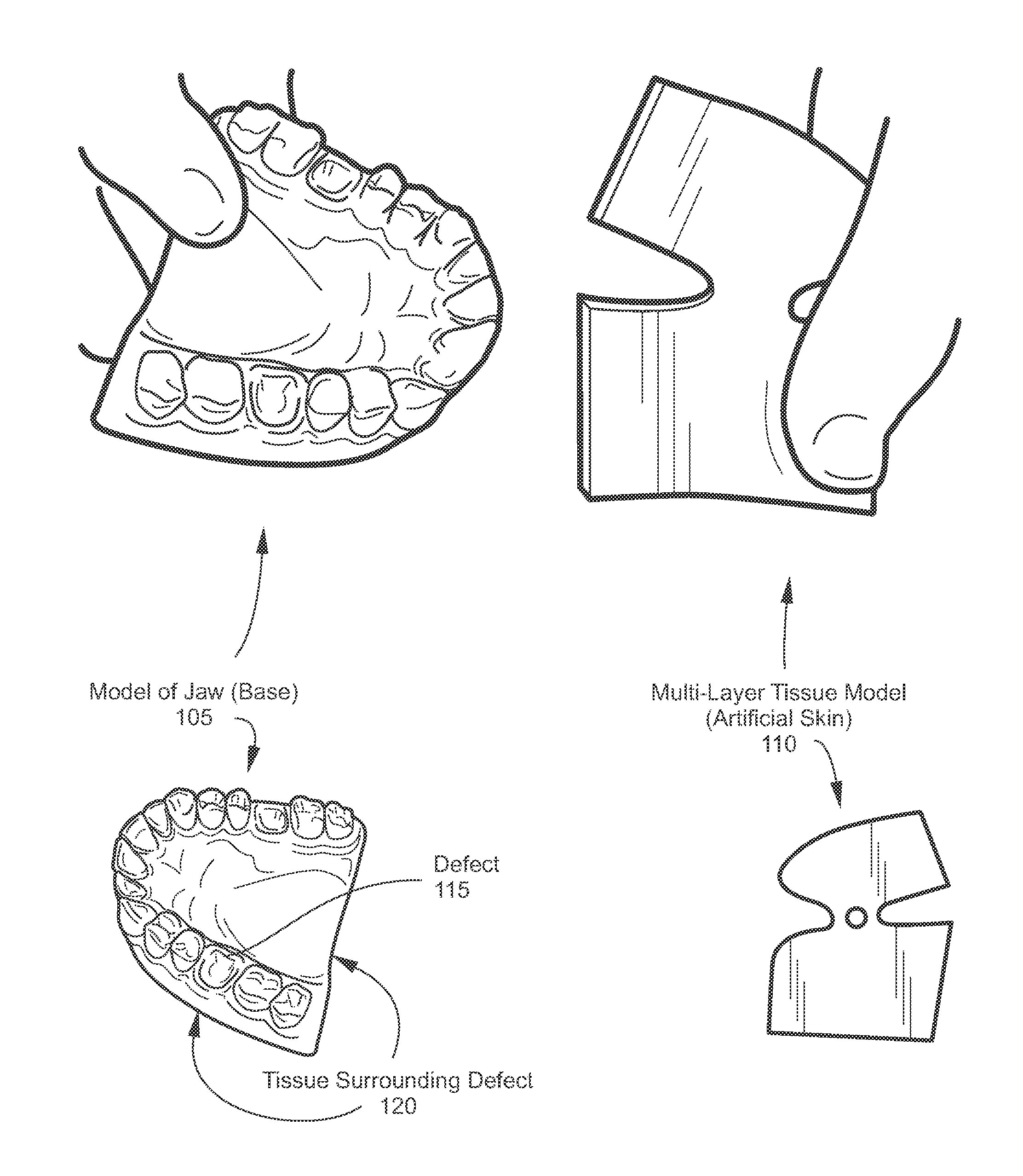 Bone augmentation training system