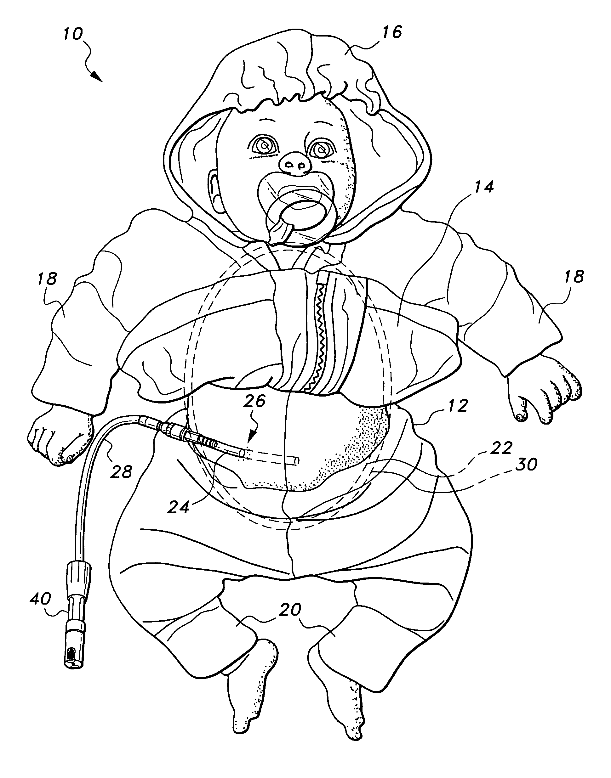 Peritoneal dialysis doll