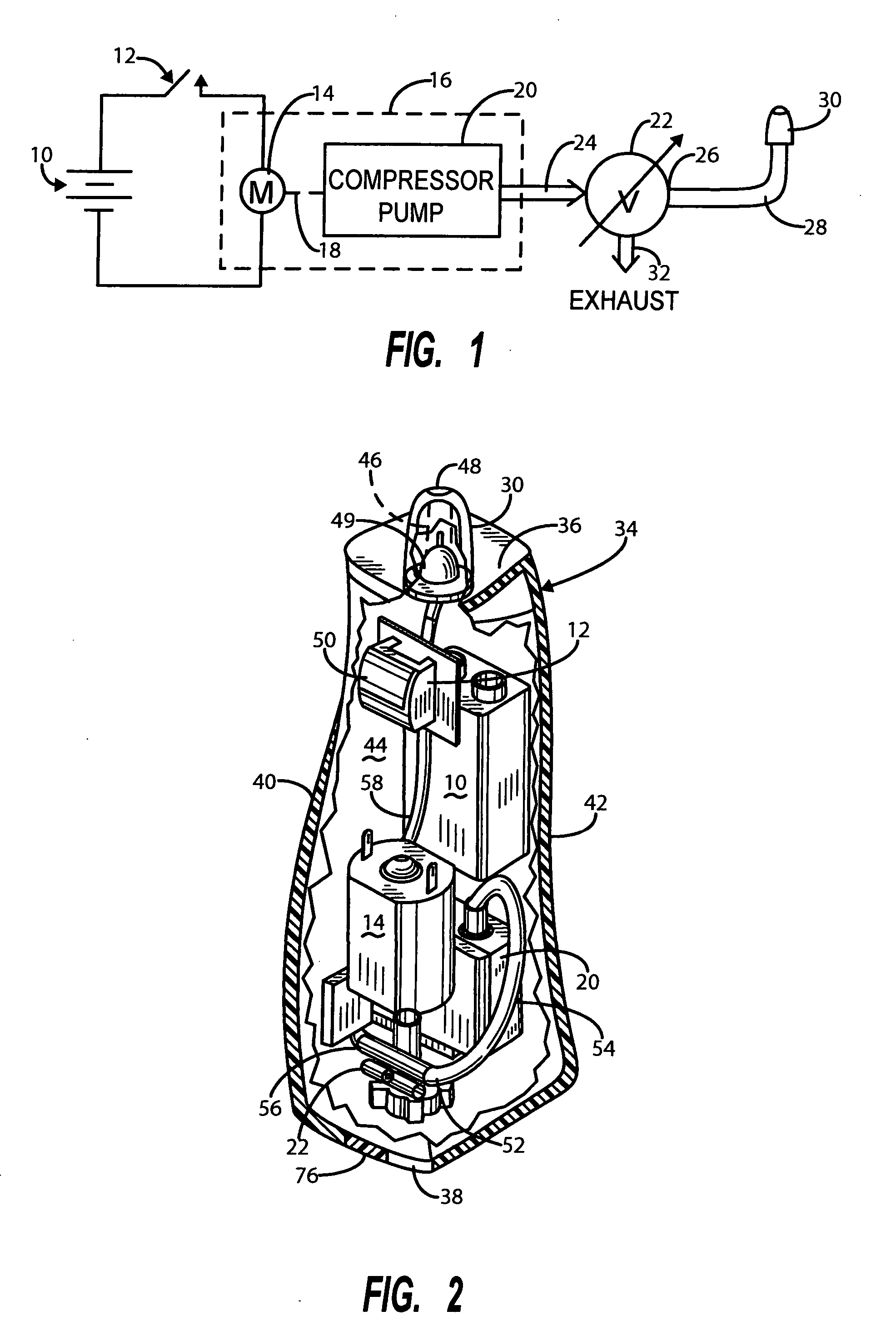 Middle ear pressure equalizing device with improved pressure control