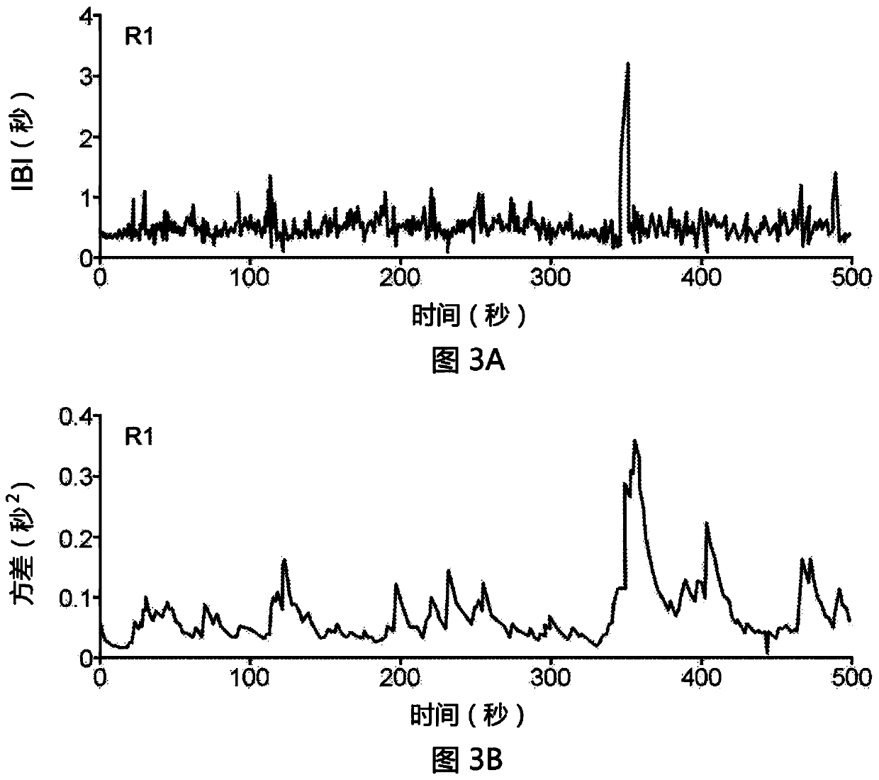 Stochastic stimulation to improve infant respiration