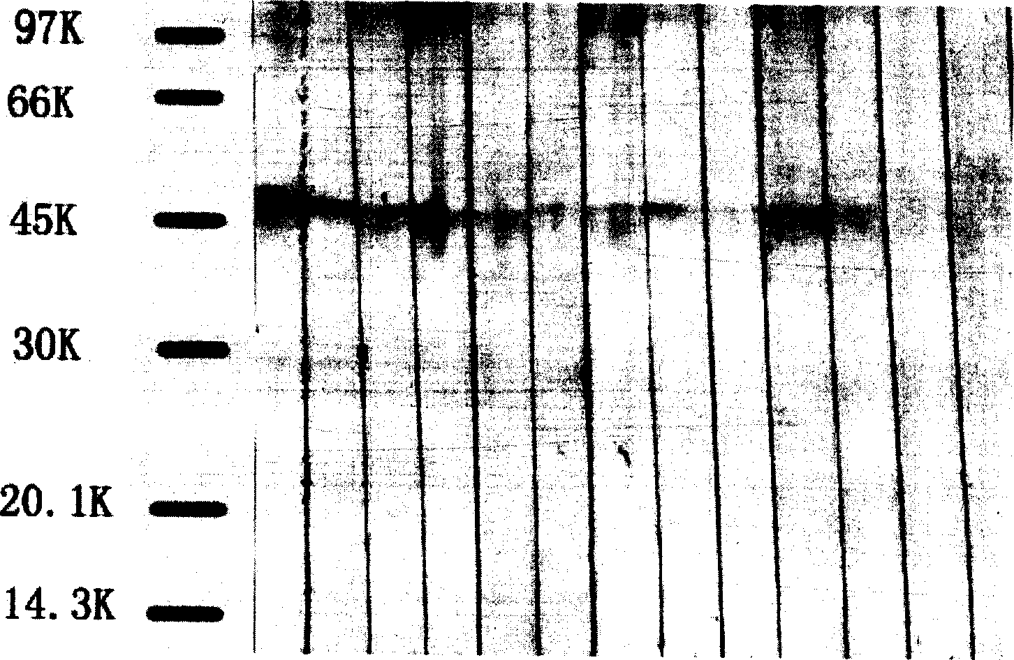 SARS coronavirus nucleocapsid protein monoclonal antibody, hybridoma for producing the same, detection agent containing the same and use thereof