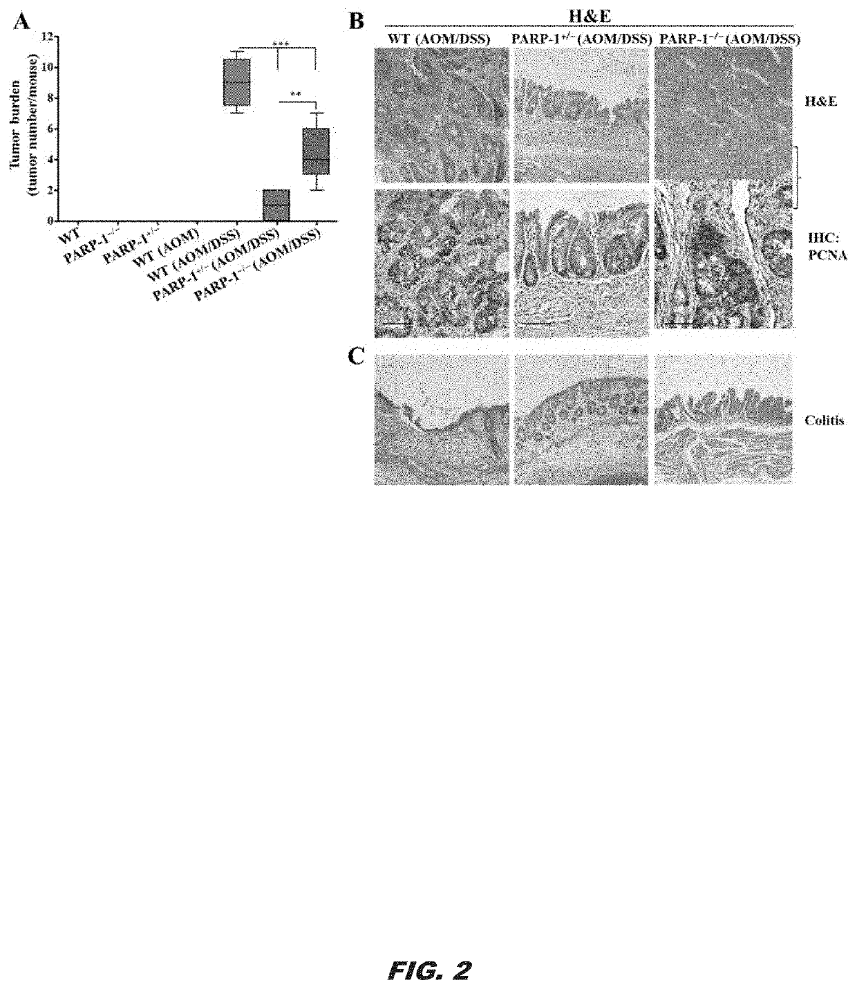 Parp-1 and methods of use thereof