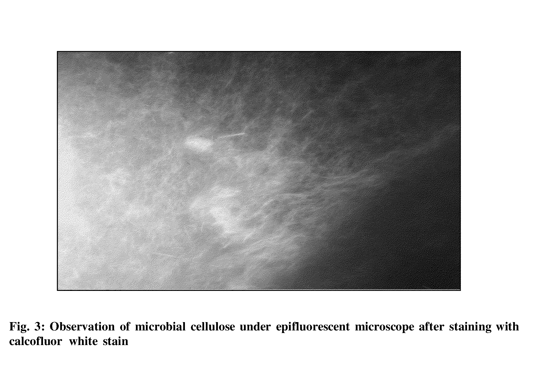 Novel isolated bacterial strain of gluconacetobacter oboediens and an optimized economic process for microbial cellulose production therefrom