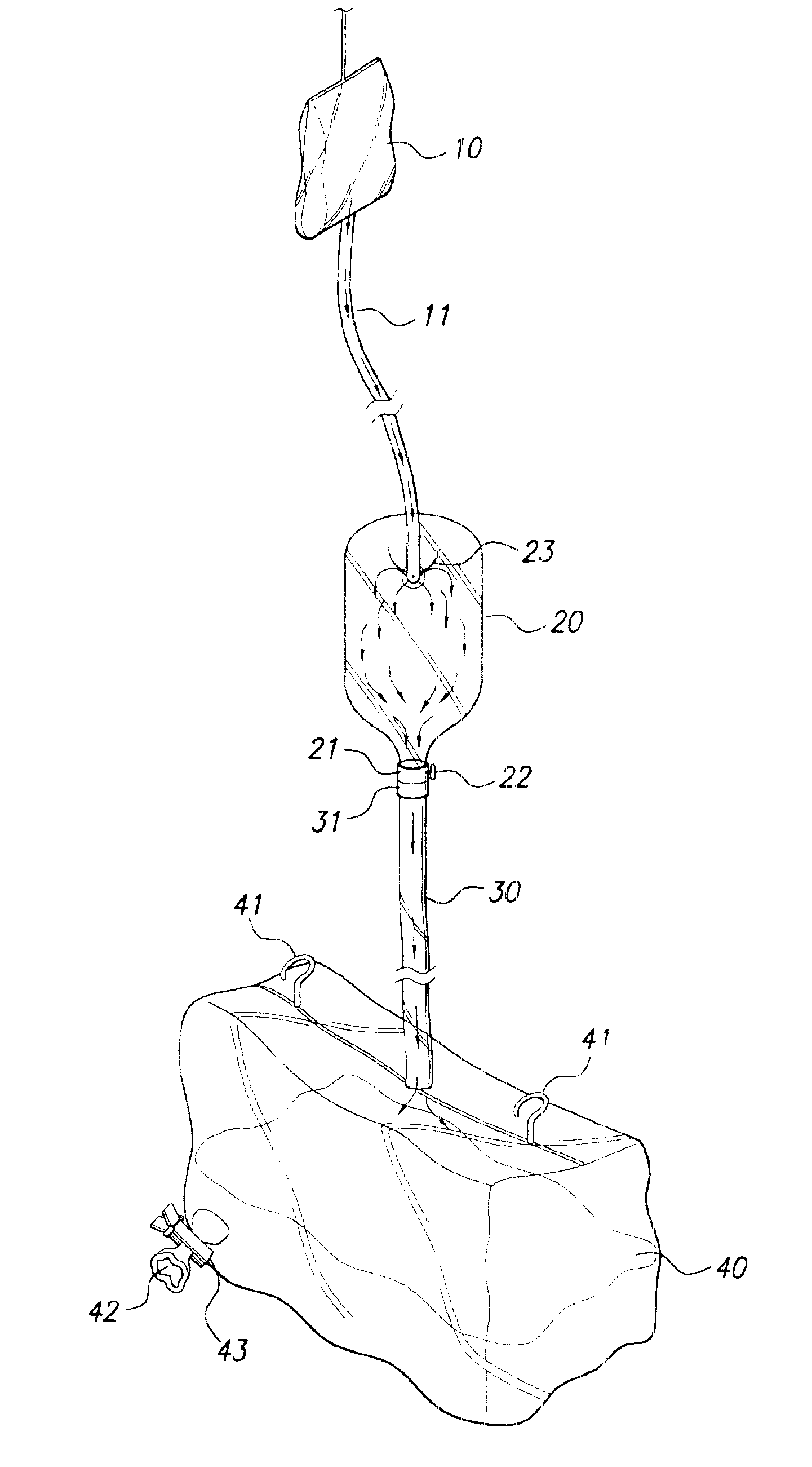 Closed drainage system for irrigating ostomies