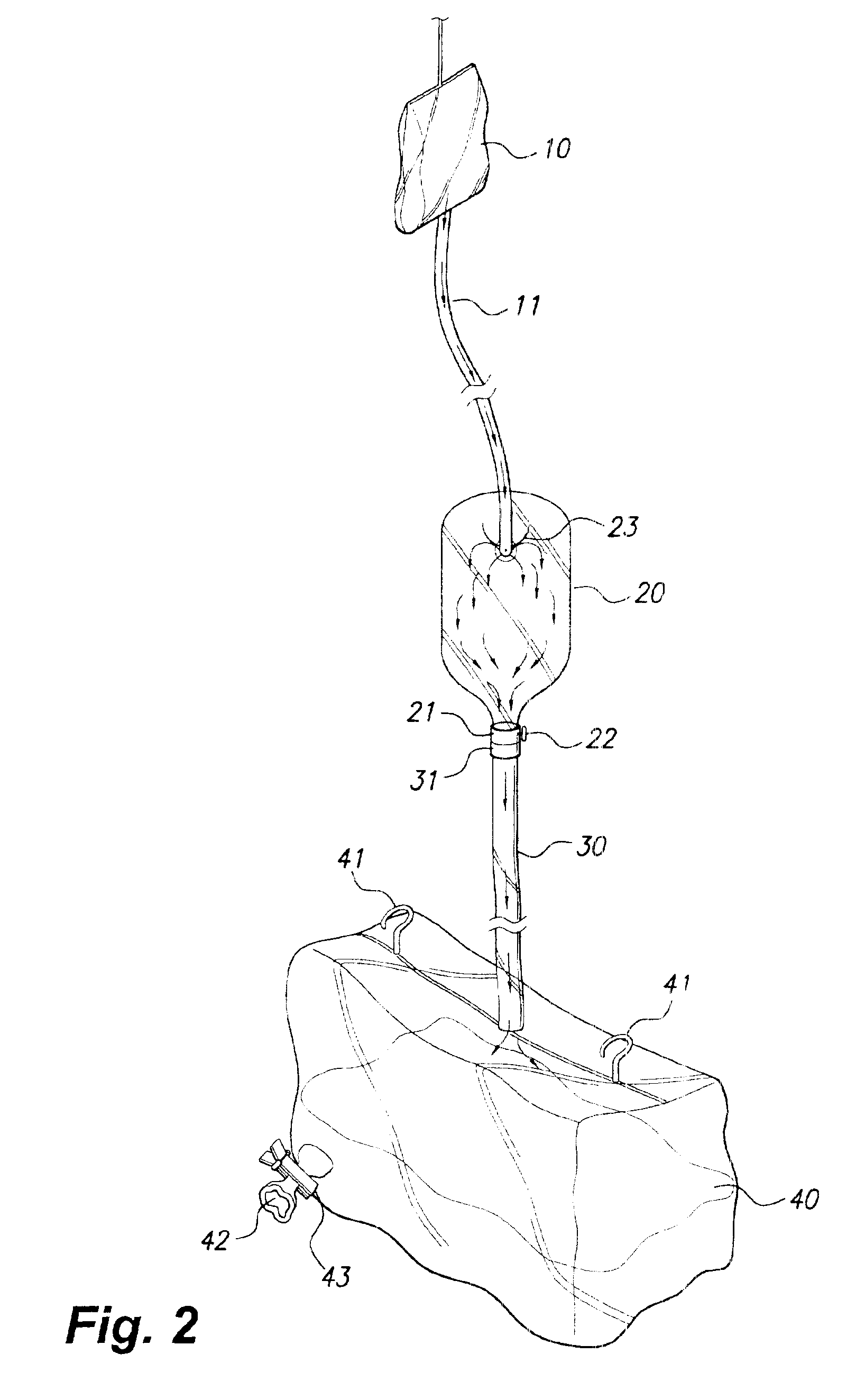 Closed drainage system for irrigating ostomies