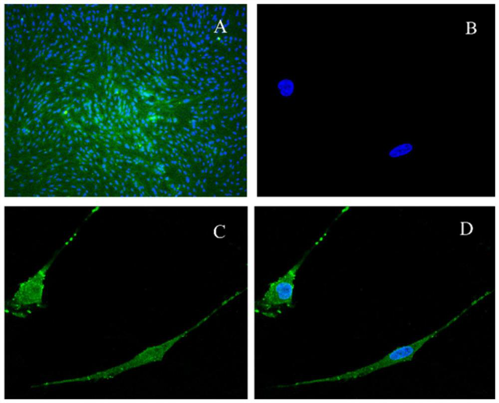 A pharmaceutical composition for resisting cerebral ischemia-reperfusion injury and its application