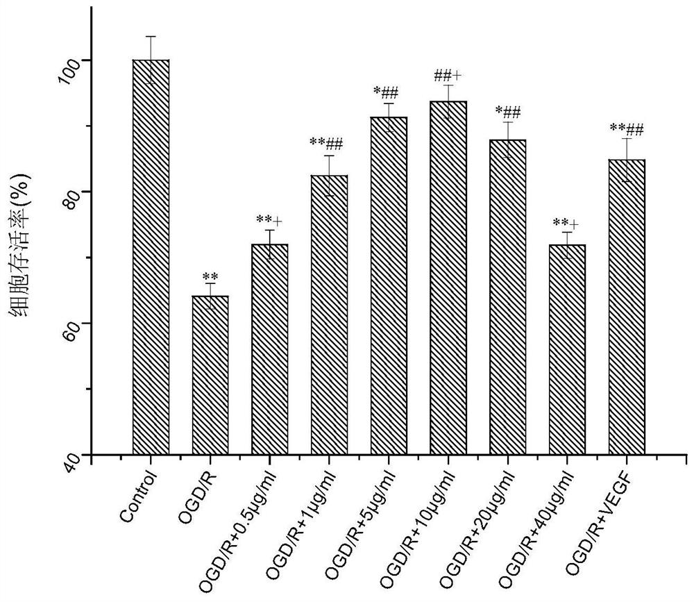 A pharmaceutical composition for resisting cerebral ischemia-reperfusion injury and its application